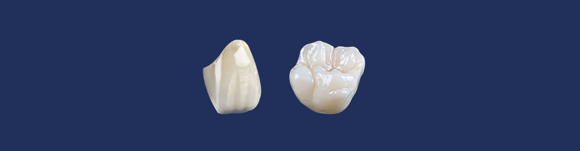Porcelain dental crowns at VIP Dental Lounge in Portage Park, Chicago