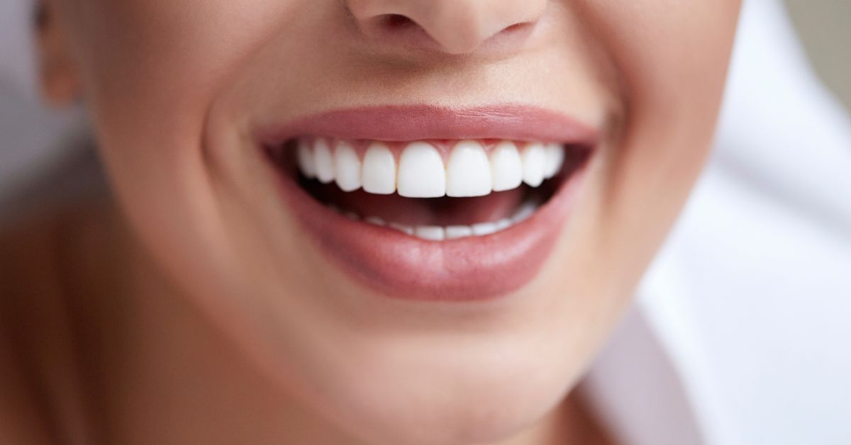 care for your teeth after professional teeth whitening
