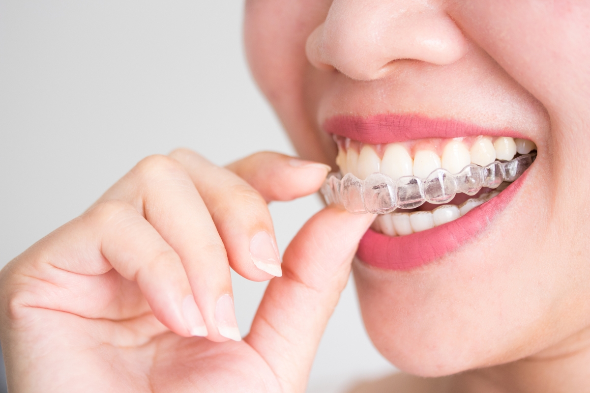 Invisalign-in-Portage-Park